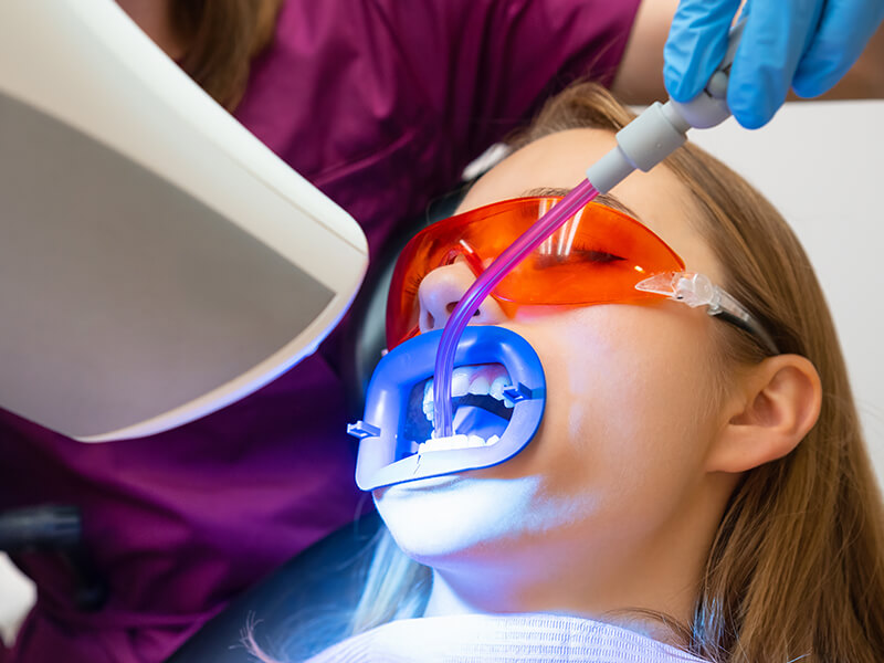 clareamento dental