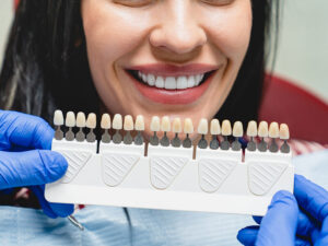 facetas de porcelana