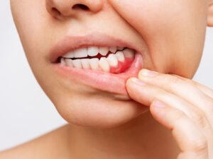 periodontista